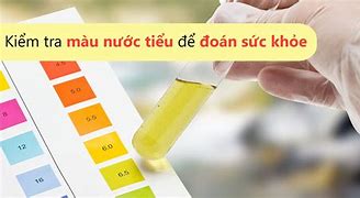 Nước Tiểu Màu Đỏ Nhạt Ở Nữ Là Bệnh Gì